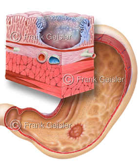 Krankheitsbilder, Krankheiten, Erkrankungen