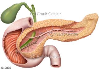  Pankreas mit Gangsystem und Duodenum eröffnet mit Gallenblase Gallengang 