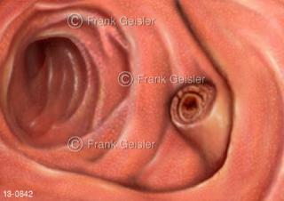 Dünndarm mit Duodenum Papille vom Gallengang Papilla duodoni major