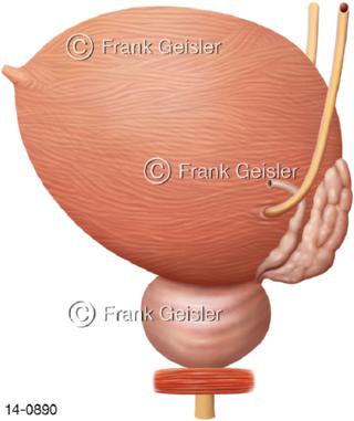 Harnblase Harnleiter Samenblase Prostata