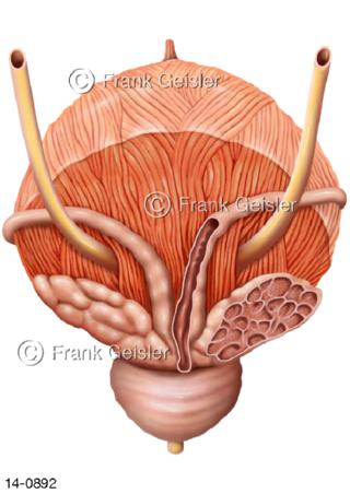 Harnblase dorsal, Samenbläschen Prostata