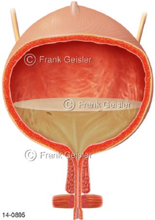 Harnblase Zystitis Blasenentzündung Blasenkatarrh