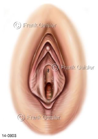 Vulva Frau, äußere Geschlechtsorgane
