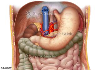Organe im Bauchraum, Bauchhöhle von ventral, Leber entfernt