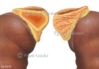 Hormondrüsen Nebennieren, Hormone werden in Rinde und Mark der Glandula adrenalis produziert