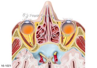 Horizontalschnitt Augen Augenmuskeln Sehnerv, Nasenhöhle Schädelhöhle mit Sehnervenkreuzung