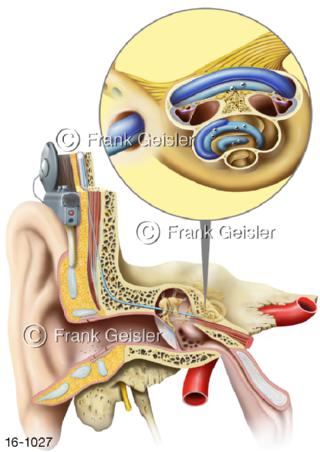 Hörorgan Ohr, Bionik Hören Gehörorgan