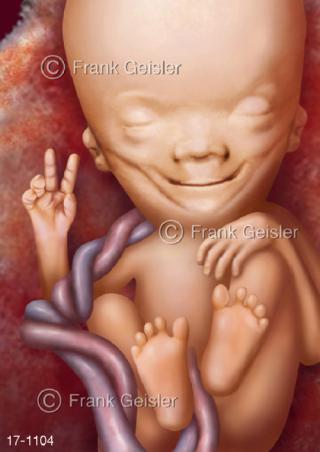 Victory Fötus Fetus 70 Tage alt