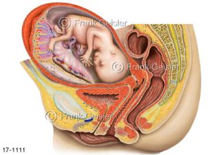 Becken Frau mit Fötus in Gebärmutter Uterus mit Plazenta