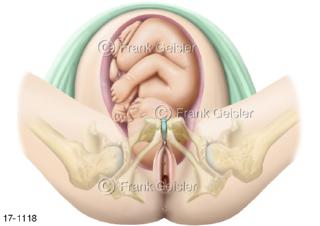  Geburt Kind, Geburtsphase frühe Latenzphase und Eröffnungsphase
