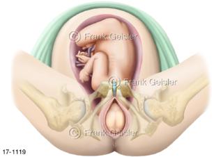 Geburt, Entbindung Kind, Geburtsphase Eröffnungsphase Eröffnungsperiode