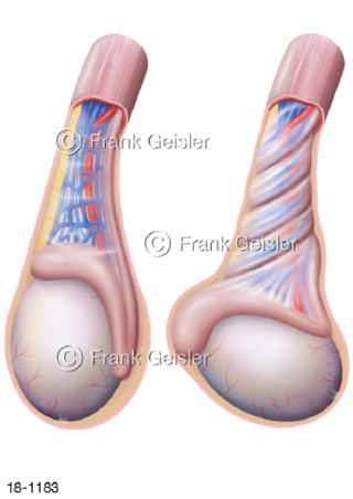 Hodentorsion, Hoden Hodendrehung