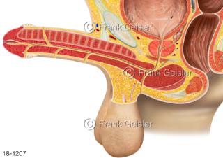 Hypospadie, angeborene Fehlbildung Harnröhre männliches Glied