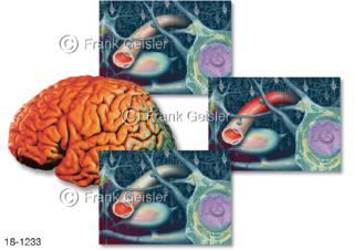 Gehirn Migräne-Krankheit Kopfschmerzerkrankung Kopfschmerzen Migräne