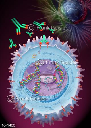 Brustkrebstherapie mit Herceptin Trastutumab