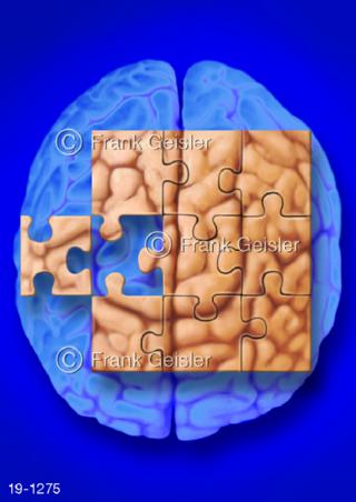 Medical-Art Neurologie Gehirn Großhirn Denken