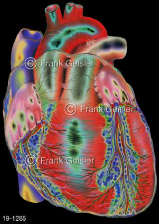 Medical-Art Kardiologie Poster Herz