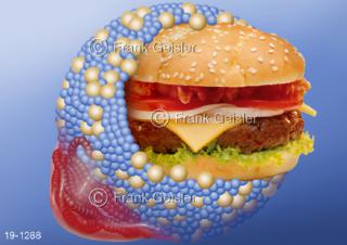 Medical-Art Ernährung, LDL Cholesterin Cholesterinbombe Burger