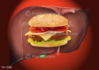 Medical-Art Ernährung, Fettbaustelle Leber Fett durch Burger
