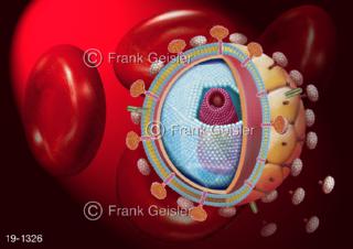 Medical-Art Blut Blutzellen mit AIDS-Virus HI-Virus HIV, ein Immunschwäche Virus