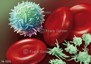 Medical-Art Blut Blutzellen Leukozyt Erythrozyten und Thrombozyten