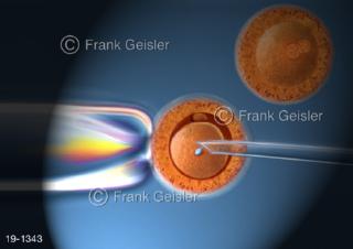 Medical-Art Befruchtung Eizellen IVF In-vitro-Fertilisation