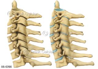 Wirbelkörper der Halswirbelsäule, Wirbel von lateral