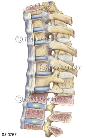 Wirbel und Bandscheiben der Lendenwirbelsäule
