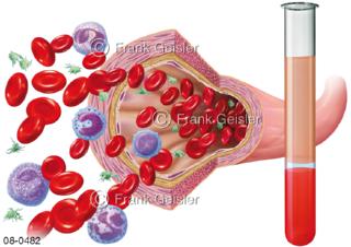 Blut, Blutbestandteile Blutplasma und Blutzellen Blutkörperchen Erythrozyten Leukozyten Thrombozyten 