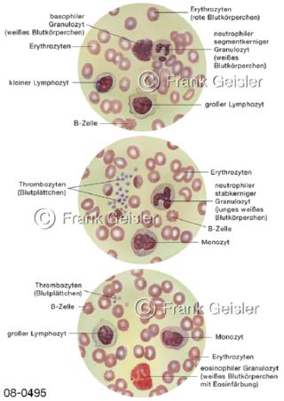 Blut, Blutausstrich von Blutzellen