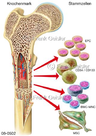 Stammzellen, undifferenzierte Zellen im Knochenmark