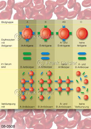 AB0-System, Blutbestimmung bei Bluttransfusion