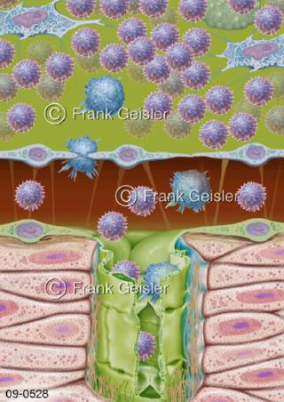 Lymphknoten, Filterung Lymphflüssigkeit