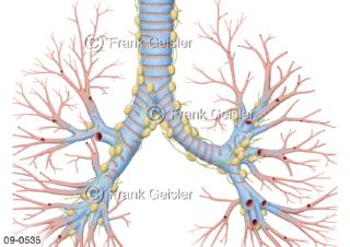 Lymphknoten und Lymphgefäße der Bronchien in der Lunge