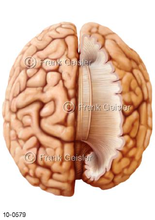 Ansicht Großhirn, Balken mit Faserbündel