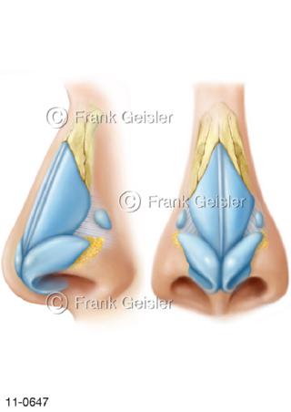 Atemtrakt Nase, Nasenskelett Nasenknorpel