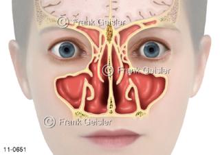  Gesicht mit Ansichten Nasenhöhle Nasennebenhöhlen Stirnhöhle