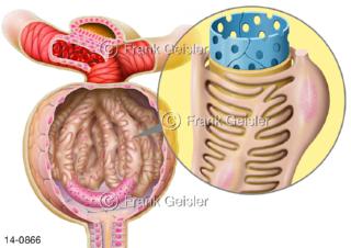 Nierenkörperchen Glomerulus, Nierenfilter der Niere, bestehend aus Kapillarknäueln