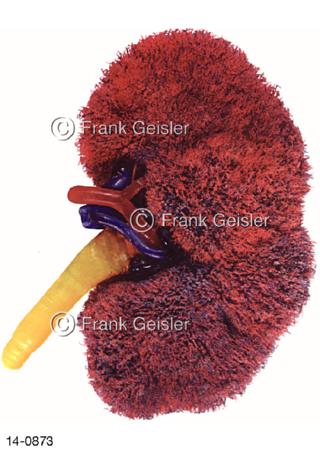 Nierengefäße der Niere, Korrosionspräparat