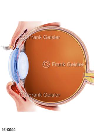 Sehorgan Auge, Augenlider Entropium mit Bindehautentzündung