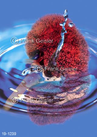 Blutgefäße Niere, Dialyse Blutreinigung Blutwäsche