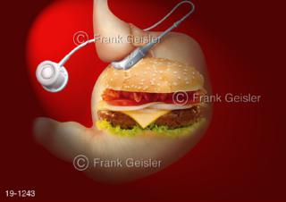 Symbol Fettsucht Adipositas chronische Fettleibigkeit, Magen Magenband und Burger