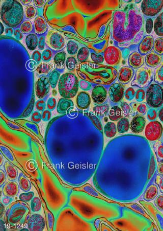 Knochenmark Blutzellen Stammzellgewebe