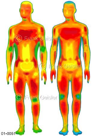 Thermografie, Wärmestrahlung am Körper des Menschen