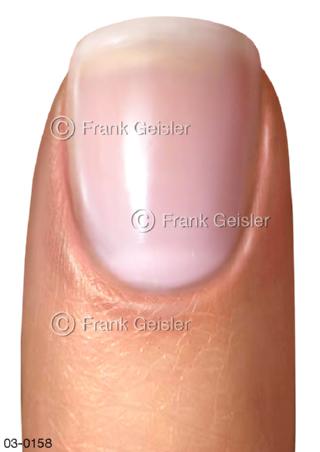 Finger, Fingerspitze mit Fingernagel, Nagelplatte