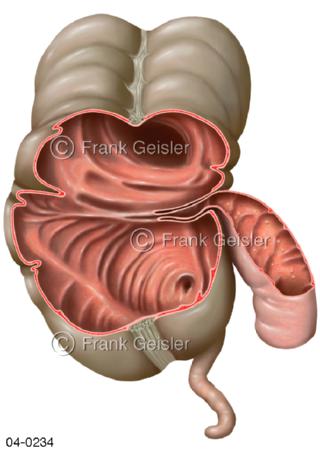 Dickdarm, Blinddarm mit Wurmfortsatz