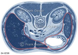 Rumpfquerschnitt, Organe mit Bauchfell, Peritoneum rot 