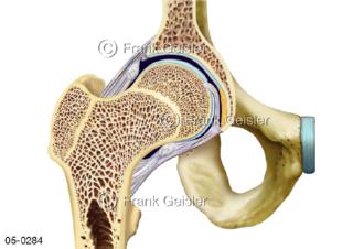 Schnittdarstellung Hüftgelenk Becken Oberschenkelknochen Femur