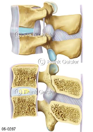 Wirbelkörper mit Bandscheibe Bänder