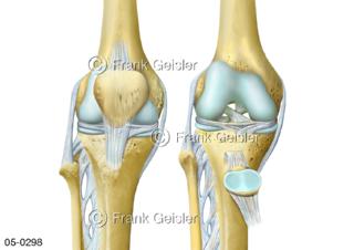 Ansichten Knie mit Kniescheibe, Kniegelenk mit Menisken
